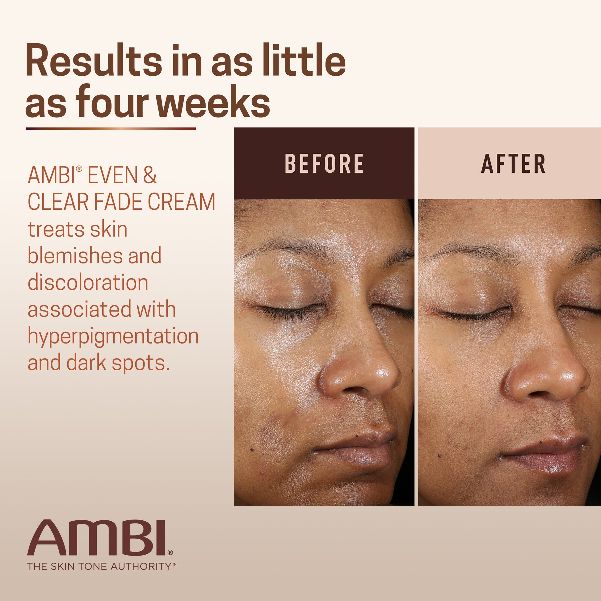 (2 pack) AMBI Even & Clear Facial Fade Cream, Hydroquinone Free, 1 oz